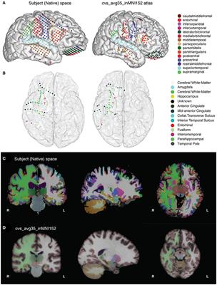 Semi-automated Anatomical Labeling and Inter-subject Warping of High-Density Intracranial Recording Electrodes in Electrocorticography